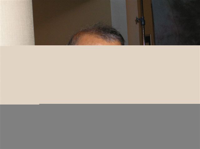 p1010027